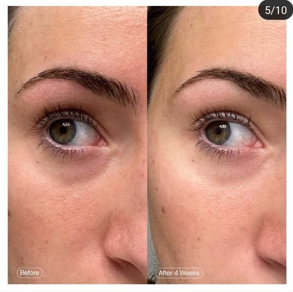 Topicals Brightening and Clearing Eye Masks (NIB) - Picture 3 of 5